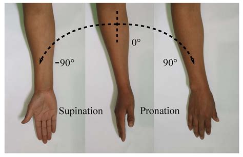 Manual Muscle Testing Of The Forearm Supination And Pronation