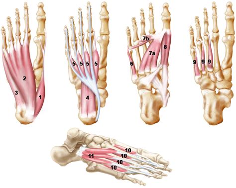 Foot muscle forces & deformities. The Foot Core System | SoleScience Custom Foot Orthotics