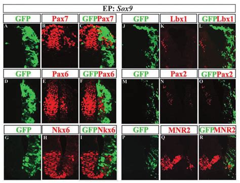 Ectopic Sox9 Expression Suppresses Neurogenesis Immunohistochemical