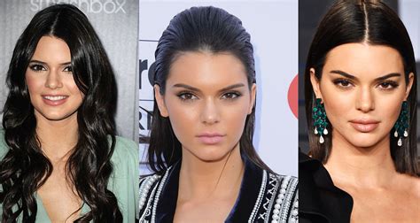 Before And After Kendall Jenners Face Transformation Who Magazine