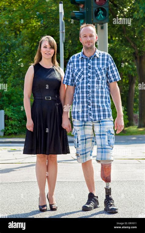Confident Handicapped Man Wearing An Artificial Limb Having Had One Leg