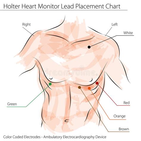 Holter Heart Monitor Lead Placement Chart Stock Vector Illustration Of Diagram