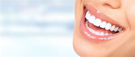 Blanqueamiento Dental Clinica Nudent Trujillo Ortodoncia Implantes
