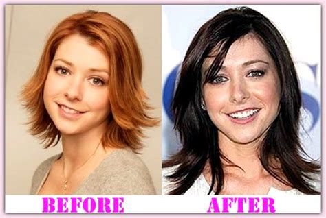 Alyson Hannigan Plastic Surgery A Success Plastic Surgery Alyson