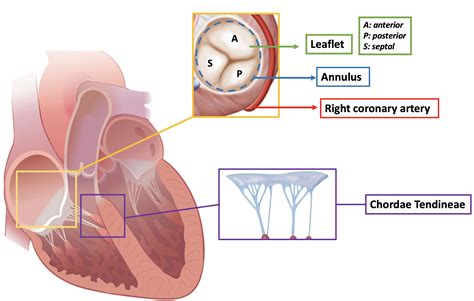 Modeling Of The Tricuspid Valve And Right Ventricle In 48 Off