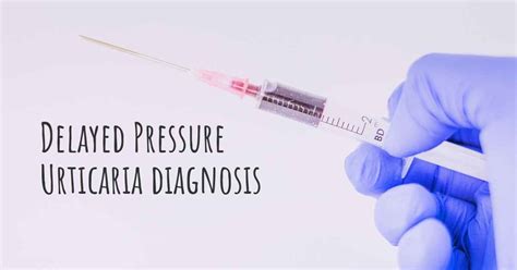 How Is Delayed Pressure Urticaria Diagnosed
