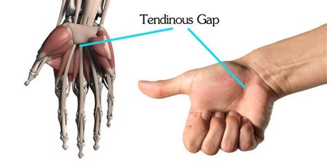 Proko How To Draw Hands Muscle Anatomy Of The Hand