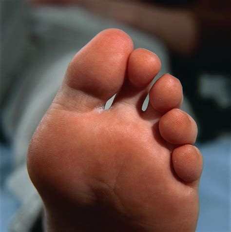 Healthy Toes And Sole Of A Womans Foot Photograph By Damien Lovegrove