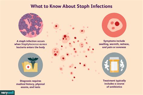Staph Infection Symptoms Diagnosis Treatment And More