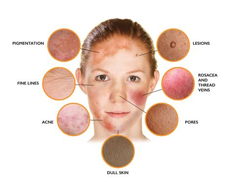 Skin Problem Image Brightnewme Is A Clinic Based In Altrincham