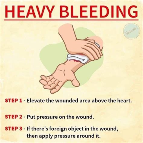 First Aid For Severe Bleeding