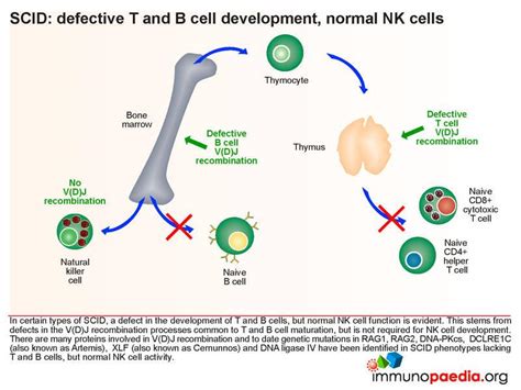 Scid Detective T And B Cell Development Normal Nk Cells Immunopaedia