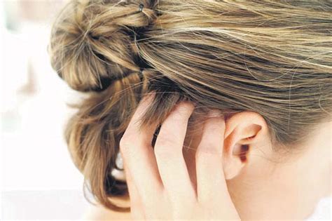 When you suffer from a hair dye allergic reaction, you are bound to experience some symptoms directly on the affected area (contact dermatitis allergic reactions) or suffer from localized allergies might cause irritation that often affects the scalp, forehead, hairline, neck region, eyelids or ears. 6 Home Remedies For Hair Dye Allergies - Home Remedies For ...