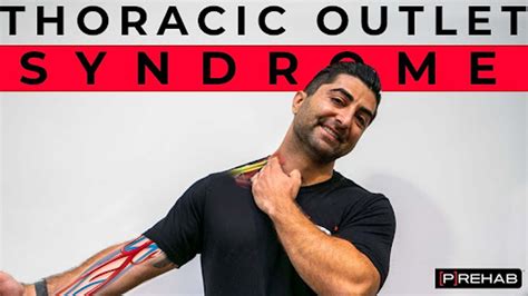 Exercises For Thoracic Outlet Syndrome P Rehab