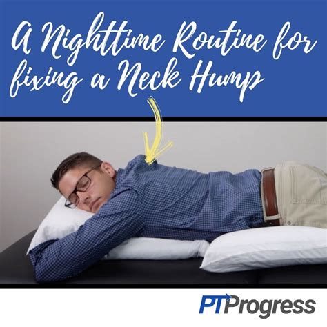 How To Fix Dowager S Hump Neck Hump At Night Posture Neck Sleep Posture Bad Posture Better