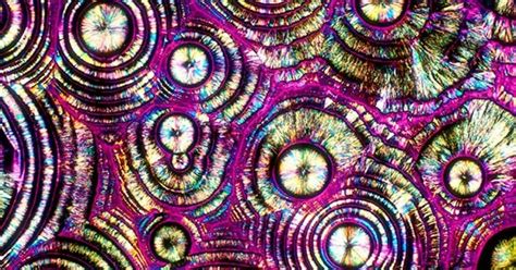 7 Totally Awesome And Terrifying Objects Under A Microscope