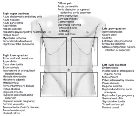 Touch Beijing Differential Diagnosis Of Acute Abdominal Pain By Location