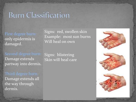 A burn is a type of injury to skin, or other tissues, caused by heat, cold, electricity, chemicals, friction, or radiation (like sunburn). PPT - Skin Disorders: Burns & Skin Cancer PowerPoint ...
