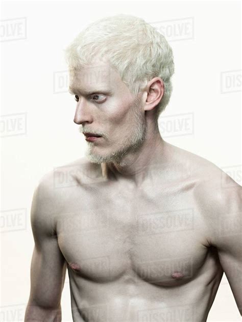 Albino Man Stock Photo Dissolve