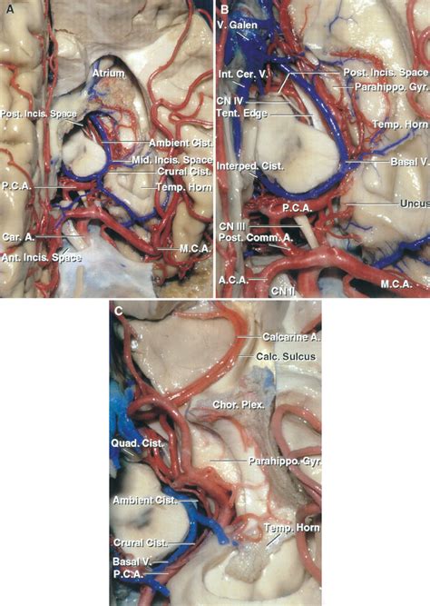 Superior Views Of The Anterior Middle And Posteriorincisural Spaces Neuroanatomy The