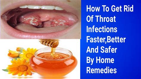 How To Cure Throat Infection Fast Cure Tonsillitis Without Antibiotics