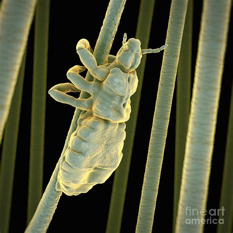 Head Louse Photograph By Science Picture Co Fine Art America