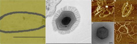 Scientists Discover Year Old Giant Virus In Siberia The Vintage News