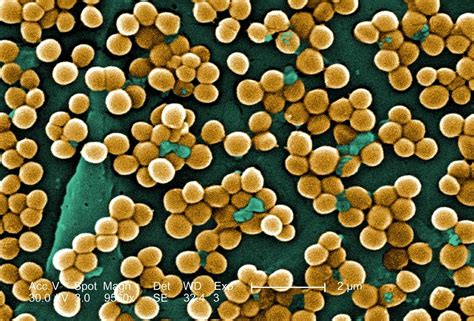 What Is Mrsa Staph Infections Live Science