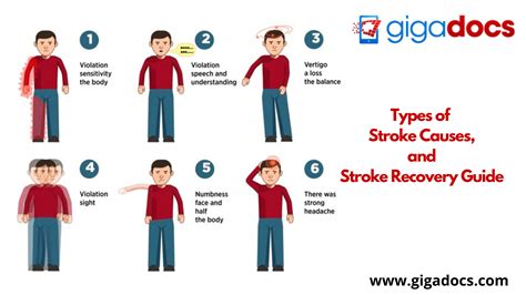 Causes Of Stroke Chart