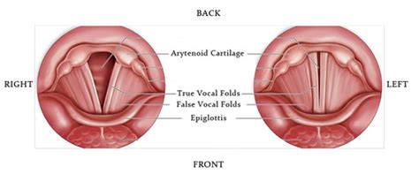 True And False Vocal Cords Sharedoc