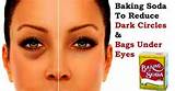 Pictures of Home Remedies Bags Under Eyes Dark Circles