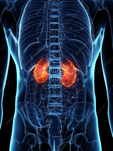 Diseased Kidney Conceptual Illustration Stock Image F0269594