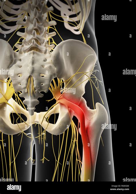 Sciatic Nerve High Resolution Stock Photography And Images Alamy