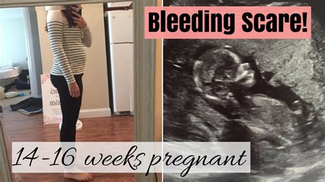 14 16 Weeks Pregnant Bleeding Scare Sch Youtube