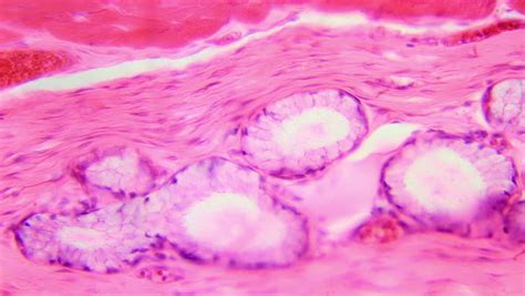 Stratified Squamous Epithelium Under The Stock Footage Video 100