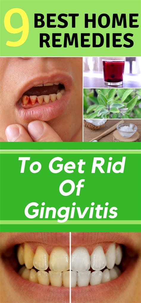 What Is The Fastest Way To Cure Gingivitis Mastery Wiki