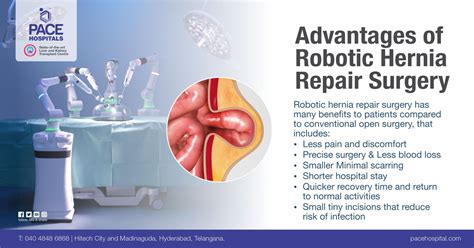 Best Hospital For Robotic Hernia Surgery In Hyderabad Pace Hospitals