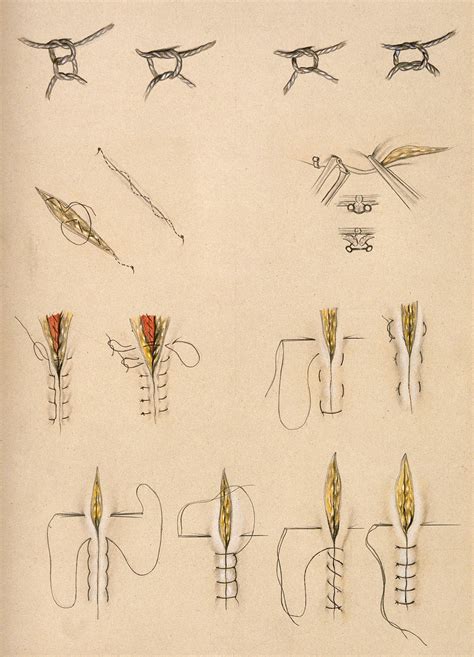 Surgical Stitches And Knots Coloured Pencil Drawing Wellcome Collection