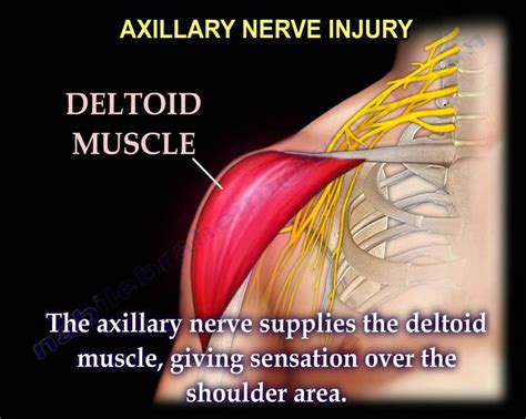 Nerve Injury Injuries Complete Everything You Need To Know Dr N