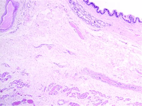 Photomicrograph Showing Respiratory Epithelium Along With Sweat Glands