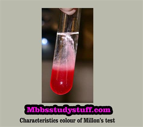 (test for detection of tyrosine) significanes: Millon's test - Medical Study Zone