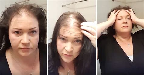 nervous woman goes to reveal her thinning hair but ends up with a whole new look hairstyles