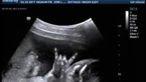 Couple Shocked To See Baby In Sonogram Flashing The Rock On Sign