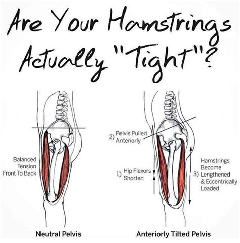 Pin By Rebekah Reid On Back Health Tight Muscles Tight Hamstrings Active Release Technique