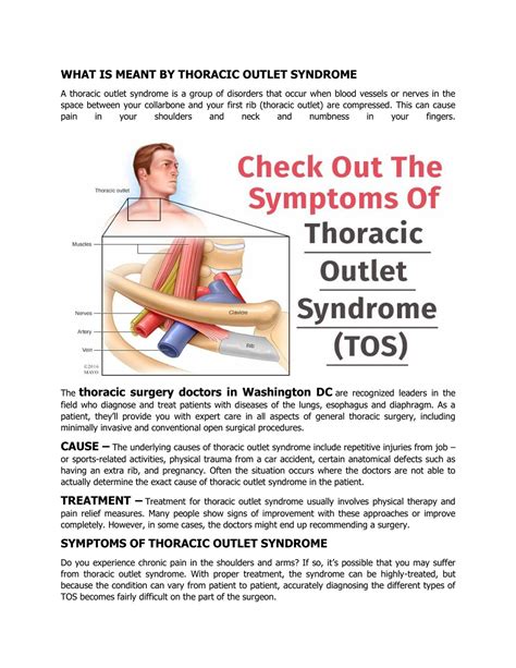 Ppt Check Out The Symptoms Of Thoracic Outlet Syndrome Tos