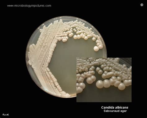 Colony Morphology And Appearance Of Candida Albicans Cultivated On