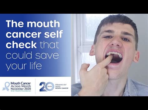 Mouth Cancer Check Up Simplyhealth Healthy Living