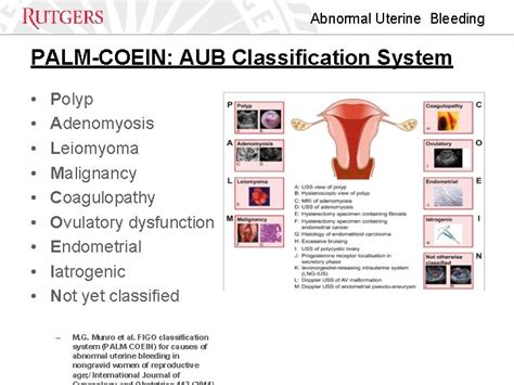 Abnormal Uterine Bleeding In Reproductive Age Women Charletta