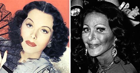 Before And After 10 Classic Hollywood Stars Who Underwent Plastic