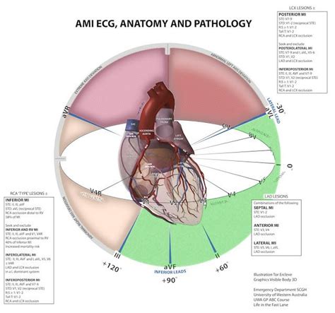Ivline A Quick Guide To Ecg Ekg Ekg Interpretation Cardiac Nursing